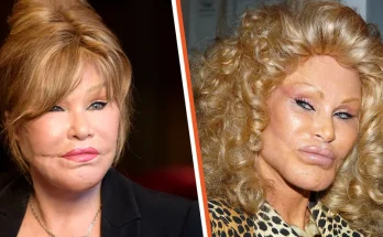 How ‘Catwoman’ Jocelyn Wildenstein Would Look If She Never Changed Her Appearance – Photos via AI