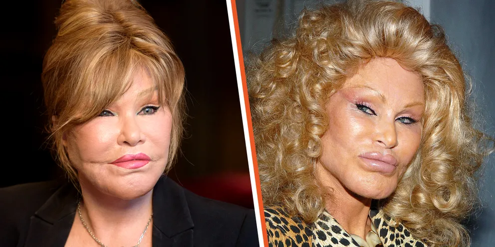 How ‘Catwoman’ Jocelyn Wildenstein Would Look If She Never Changed Her Appearance – Photos via AI