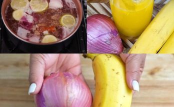 Banana and Onion Remedy for Joint Pain: A Natural Approach Worth Trying