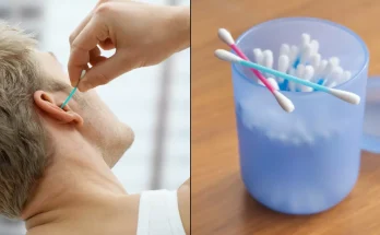 Doctor's warning as he reveals why you should never clean your ears with cotton buds