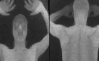 People horrified at what airport security were able to see when passengers walked through X-Ray machine