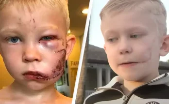 Boy hailed hero after risking his life to save sister from brutal dog attack