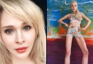 Woman Who Paid $161,000 To Extend Her Legs By 5.5 Inches Left With Huge Regrets