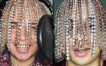 Rapper Dan Sur Says He Got Gold Chains Surgically ‘Implanted Into His Head’