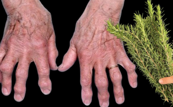 Rejuvenate Your Joints with Rosemary: Feel Energized and Pain-Free Again!