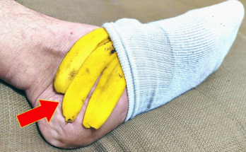 Banana Peel on Your Feet: A Surprising Natural Remedy You’ll Love