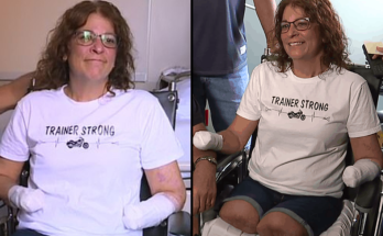 Vet Issues Urgent Warning About Kissing Your Dog After Woman Had To Have Arms And Legs Amputated