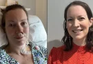 Woman diagnosed with stage four cancer shares hidden symptoms that were dismissed by doctors