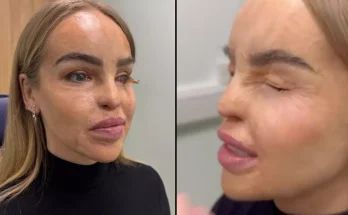 Katie Piper issues 'end of the road' health update after 'years of battling with eye'