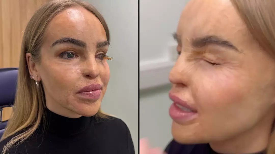 Katie Piper issues 'end of the road' health update after 'years of battling with eye'