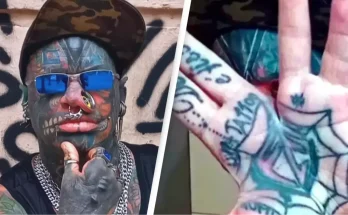 'World's most modified man' who had his hand surgically cut in half reveals why he did it