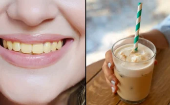 Expert explains the four common food and drink mistakes that might explain why you have yellow teeth