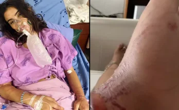 Woman issued major warning after being stung by ‘most venomous creature on earth’ that left ‘body vibrating’