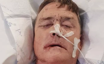 Man diagnosed with mouth cancer reveals gap in his teeth was a warning sign that everyone should know about