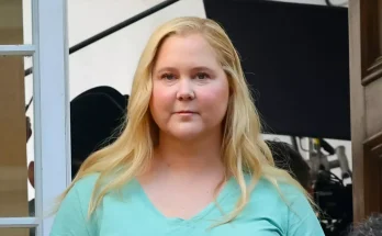 Amy Schumer's condition explained following 'moon face' comments that sparked diagnosis