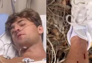 Influencer starts filming seconds after being bitten by highly venomous rattlesnake