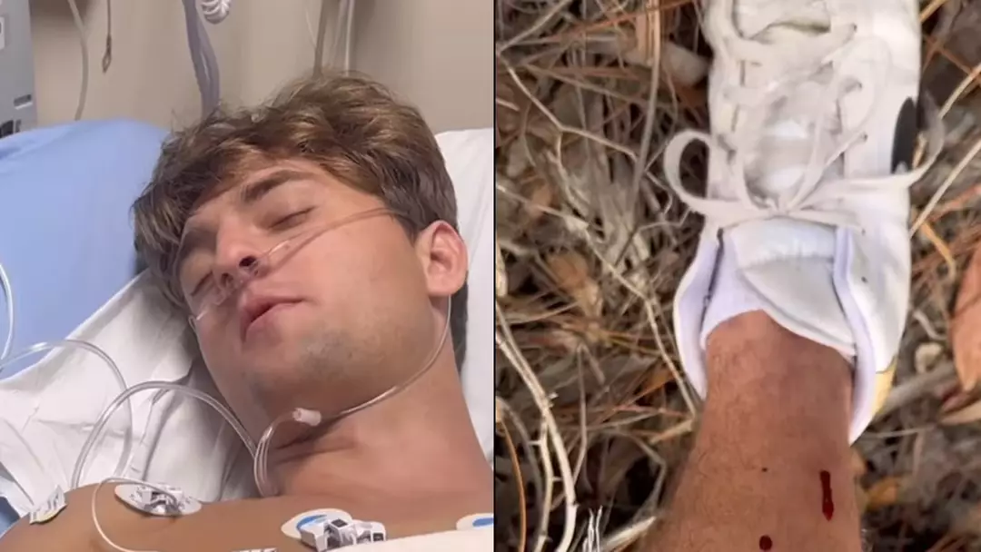 Influencer starts filming seconds after being bitten by highly venomous rattlesnake