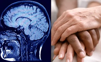 Scientists record human brain as someone dies and make incredible revelation