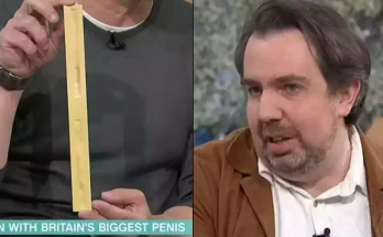 Man with 'world's biggest penis' reveals thing he must do every time he wears shorts