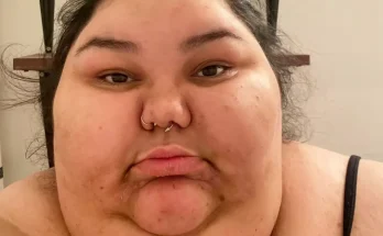 Woman shows off incredible 30 stone weight loss after making simple tweaks following cancer scare